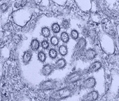 2009H1N1-tissuesample