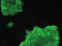 Bartonelosis: ¿Qué sabemos? ¿Qué podemos hacer?