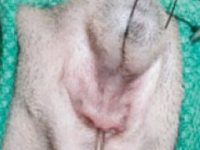 Diagnóstico y tratamiento quirúrgico de la atresia anal