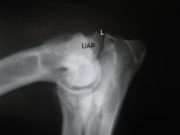 Proceso coronoides medial fragmentado traumático, Parte 1: Diagnóstico