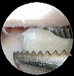 veterinary0710_elbow_Fig3