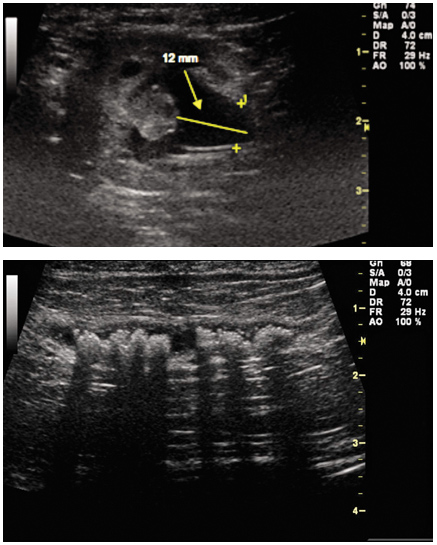 radiology1110_fig2a