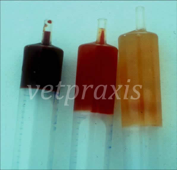 Diversos tipos de exudados pleurales, pueden apreciarse macroscópicamente que tienen características diferentes entre si.