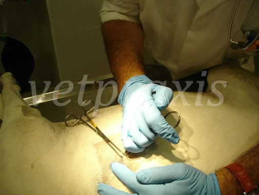 Por la cara anterior de la 9ª costilla, controlando desde el exterior y colocando el mosquito oblicuo con respecto a la pared torácica, penetramos la pared costal con la punta del mosquito.