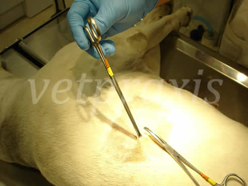 Un mosquito curvo nos permite hacer un túnel subcutáneo que llega hasta el borde craneal de la 9ª costilla.