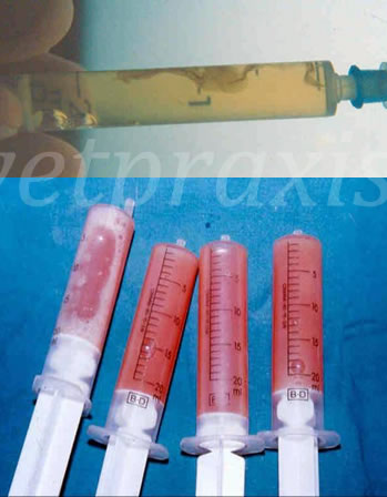 Exudados inflamatorios; mientras uno es relativamente transparente y se aprecian los depósitos de fibrina, en el otro hay un contenido hemático que tiñe el exudado de rojo, se aprecian la formación de espuma por el alto contenido en proteínas del líquido.