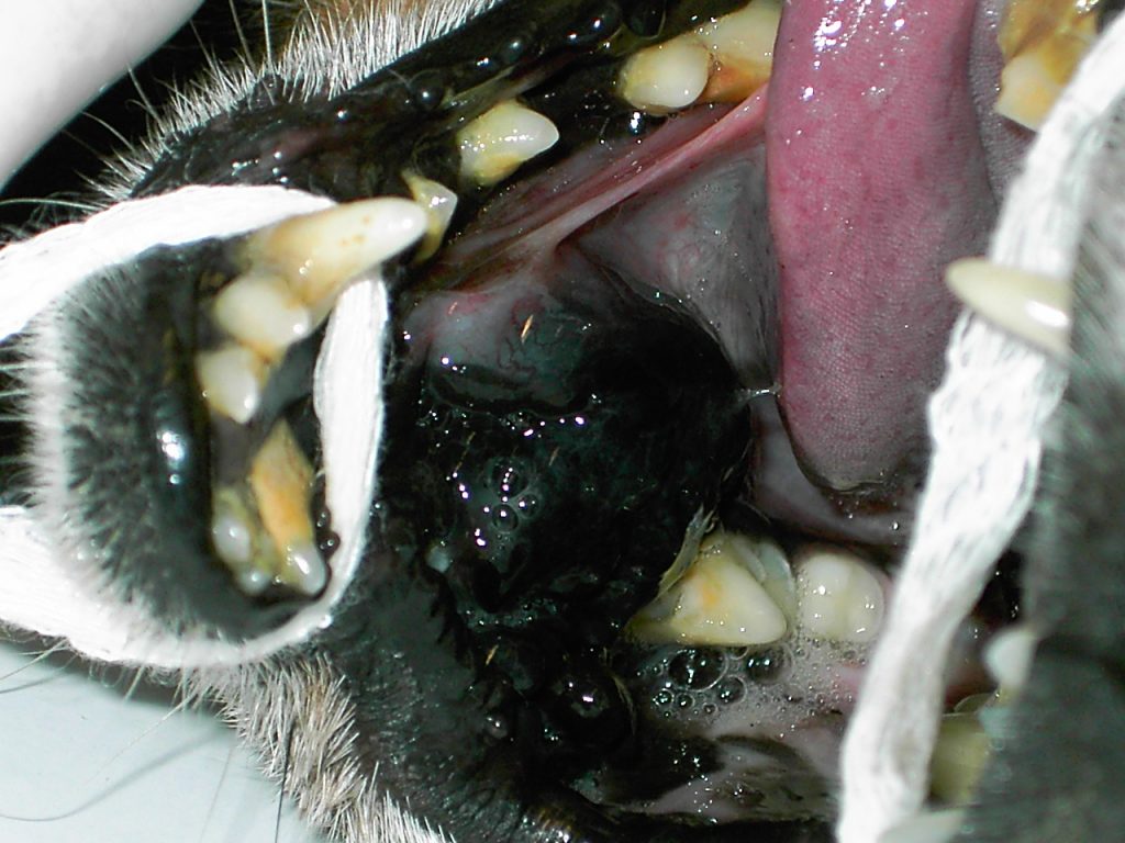 Melanoma oral