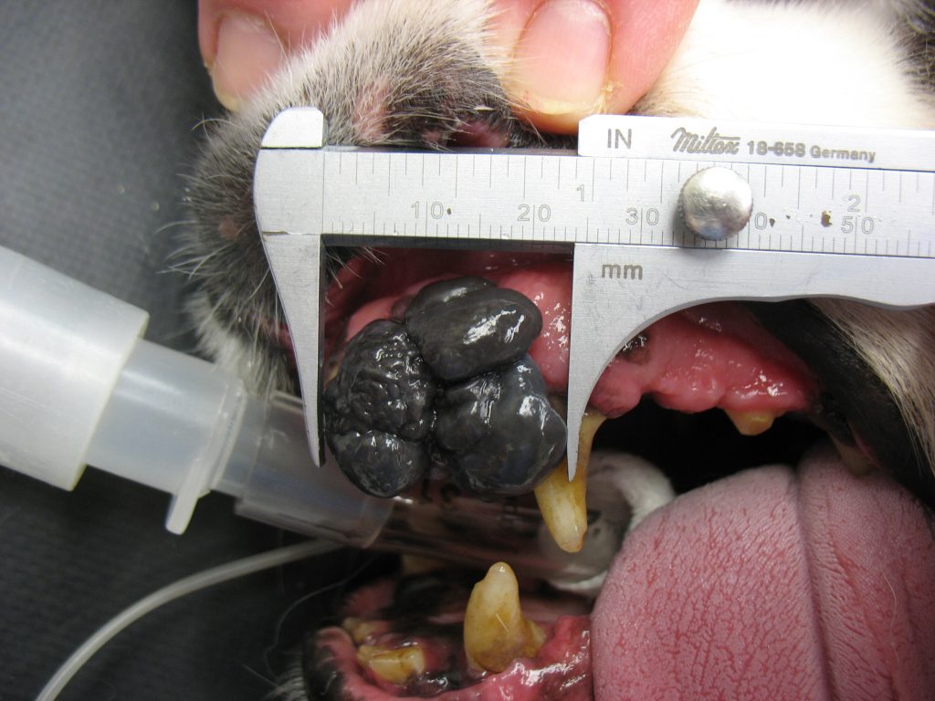 Melanoma oral
