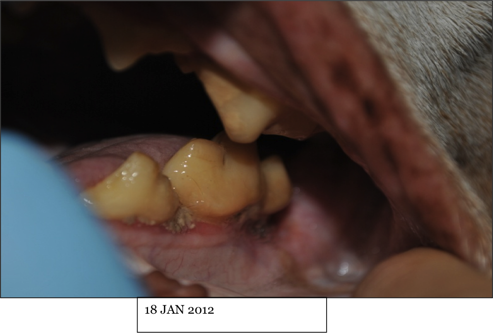 Respuesta en un caso donde se utilizó la vacuna de melanoma ONCEPT de Merial junto con radioterapia fraccionada