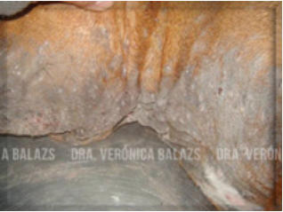 Foliculitis y furunculosis extensa profunda en un bull terrier. Se observan nódulos, furúnculos y alopecia.