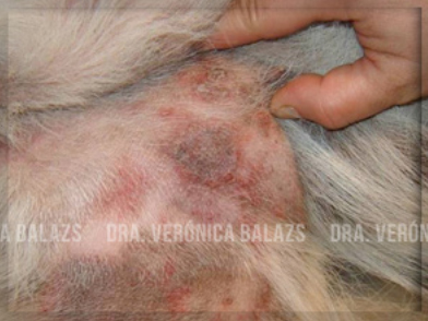 Lesión típica de foliculitis superficial: máculas de hiperpigmentación variable, con anillos eritematosos en los bordes de los collaretes.