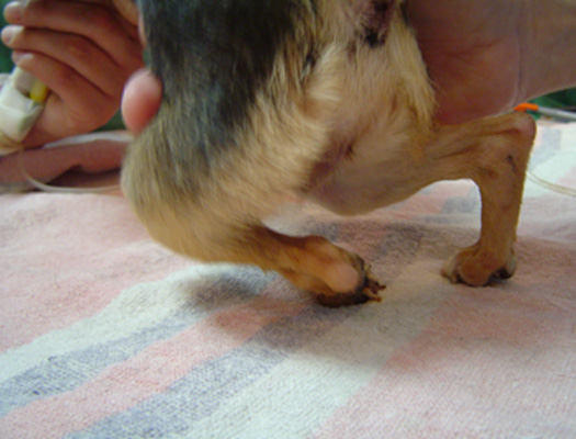 Disfunción propioceptiva conciente.