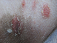 VIDEO Pioderma Canino: Un desafío diagnóstico y terapéutico
