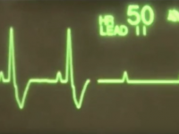 Reto Veterinario: Electrocardiografía