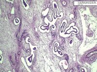 PÓLIPO ENDOMETRIAL EN CANINO CON SINTOMATOLOGÍA INESPECÍFICA: REPORTE DE UN CASO CLÍNICO 