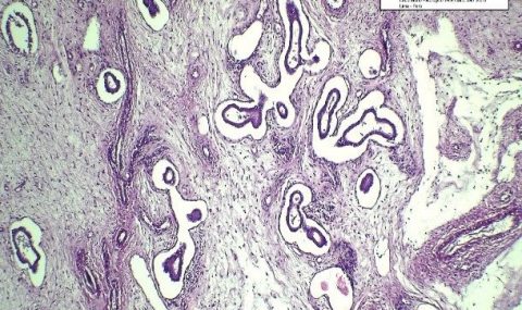 PÓLIPO ENDOMETRIAL EN CANINO CON SINTOMATOLOGÍA INESPECÍFICA: REPORTE DE UN CASO CLÍNICO 