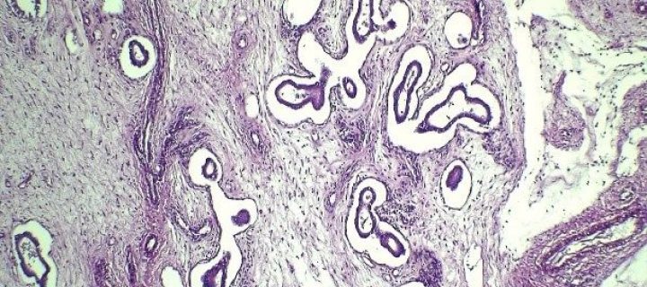 PÓLIPO ENDOMETRIAL EN CANINO CON SINTOMATOLOGÍA INESPECÍFICA: REPORTE DE UN CASO CLÍNICO 