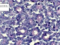 COLANGIOCARCINOMA: REPORTE DE CASO CLÍNICO EN HEMBRA CANINA MESTIZA